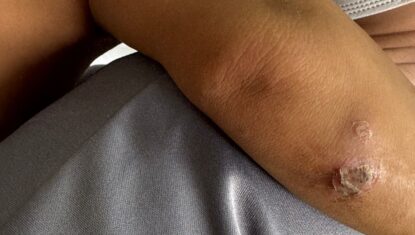 Mãe é presa suspeita de abandonar e maltratar casal de filhos gêmeos de um ano