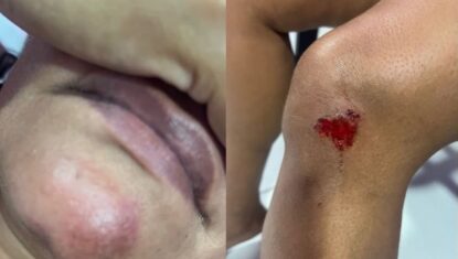 Homem arremessa companheira de carro em movimento