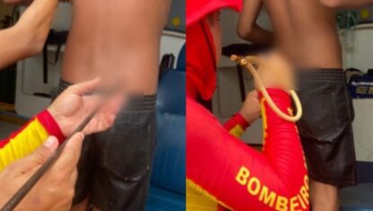 Adolescente é atingido por arpão na nádega durante pesca na Praia do Francês; amigo fez o disparo