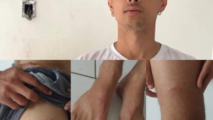 VÍDEO: Entregador é agredido após ser confundido com assaltante em Maceió e denuncia ameaças